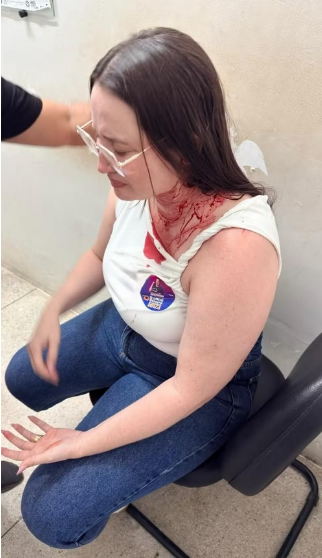 Candidata a deputada estadual em Pernambuco é atacada com pedra em caminhada em Ouricuri